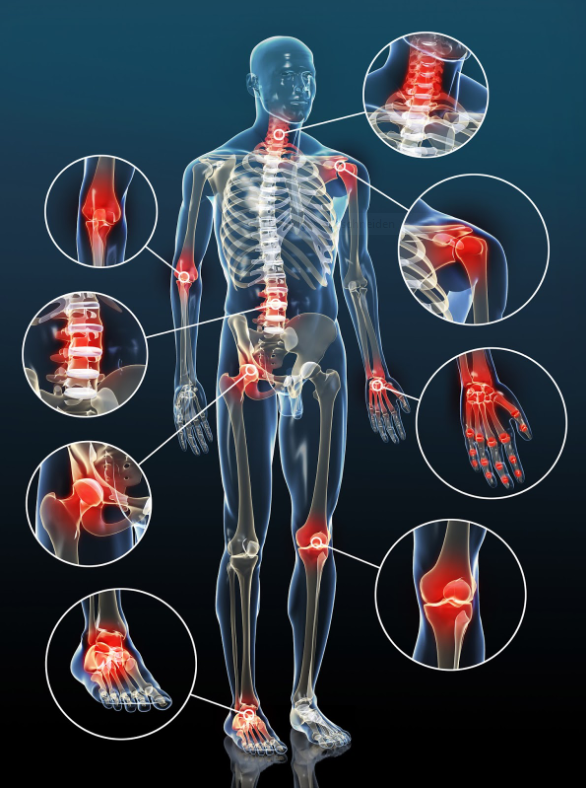 Arthrose Mann